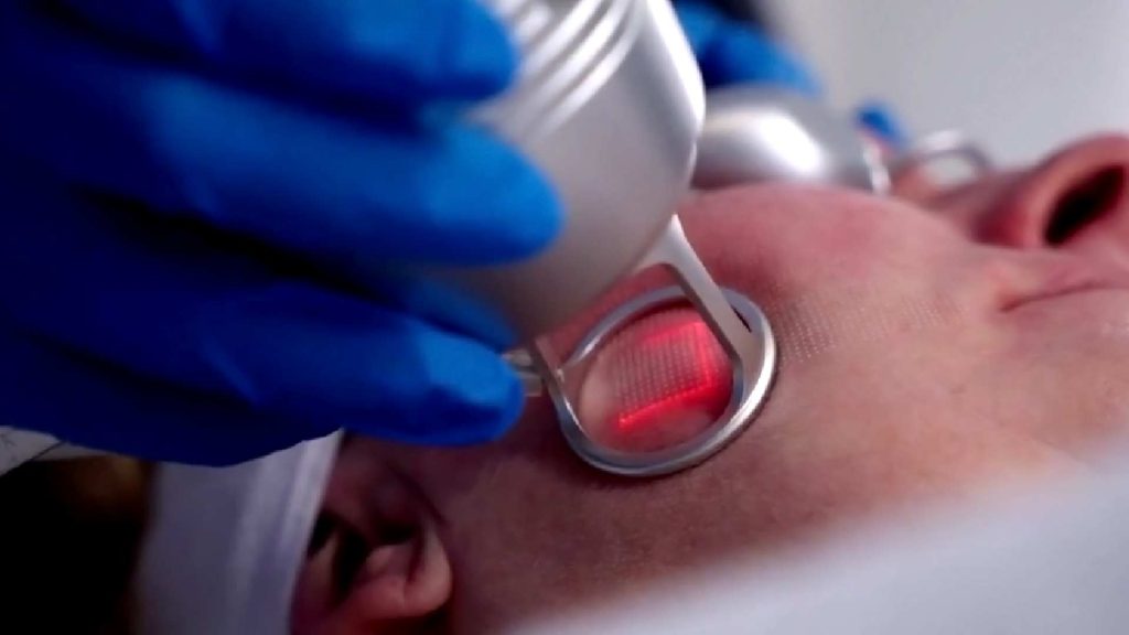 Clinic Benefits of SmartXEL CO2