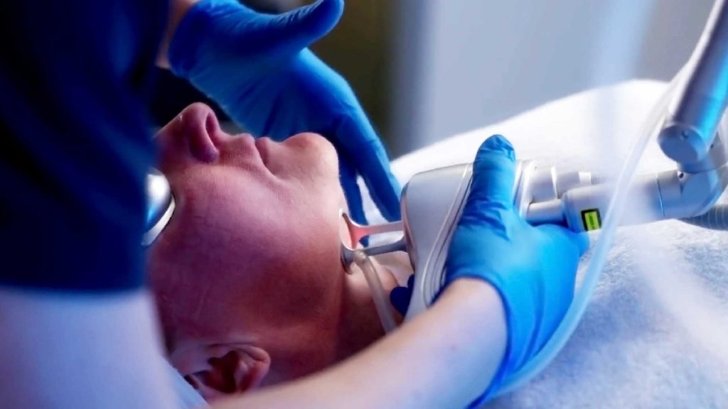 10 Benefits of CO2 Laser Resurfacing